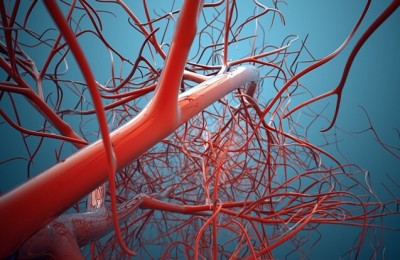 Аневризмы периферических артерий