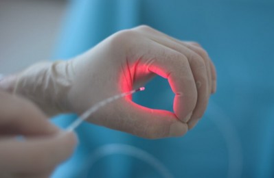 Использование лазера в флебологии